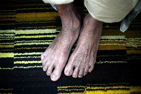 old woman soles|1,346 Old Lady Feet Stock Photos & High.